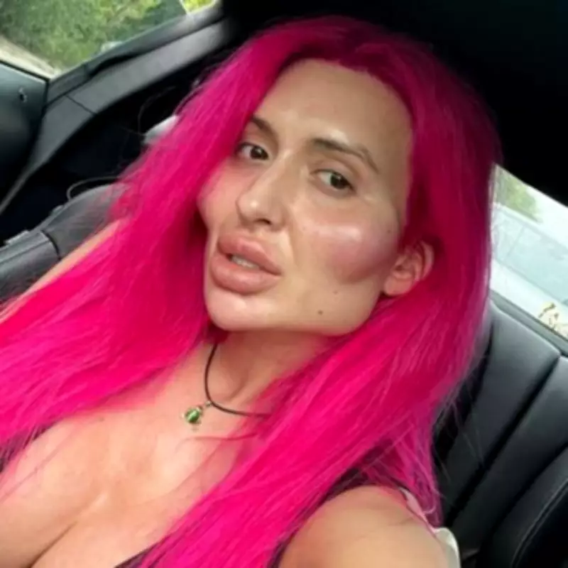 Model with 'world's biggest cheeks' decides to dissolve filler for facelift