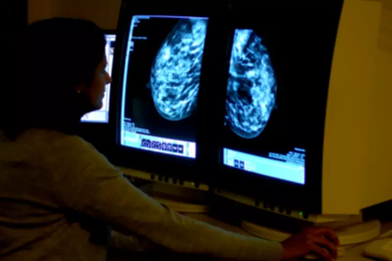 New genome test could spare millions of breast cancer patients chemotherapy