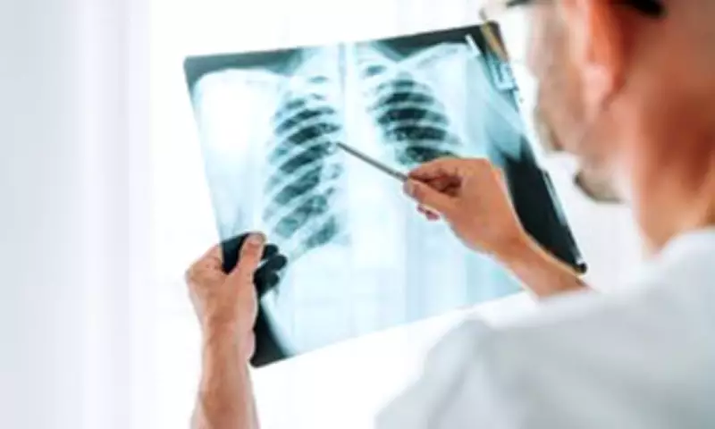 NHS Supermarket Screening Detects Thousands of Early-Stage Lung Cancers