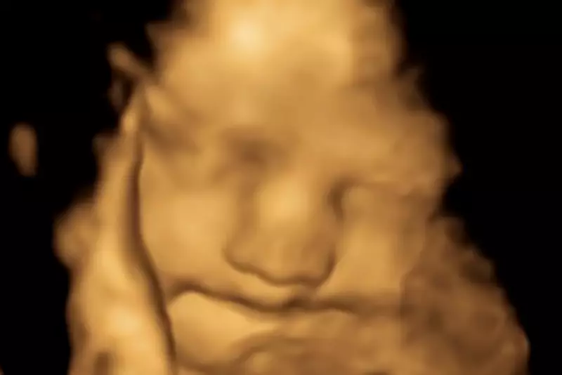 Prenatal Vegetable Exposure May Shape Kids' Food Preferences, Study Finds