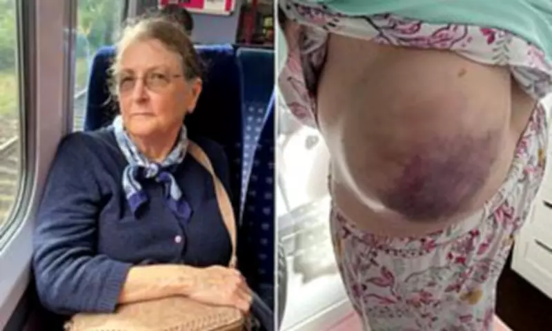 Retired NHS nurse, 75, forced to sell belongings to afford cancer treatment travel