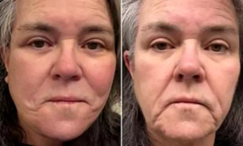 Rosie O'Donnell Reveals Secret Facelift After Feminist Crisis