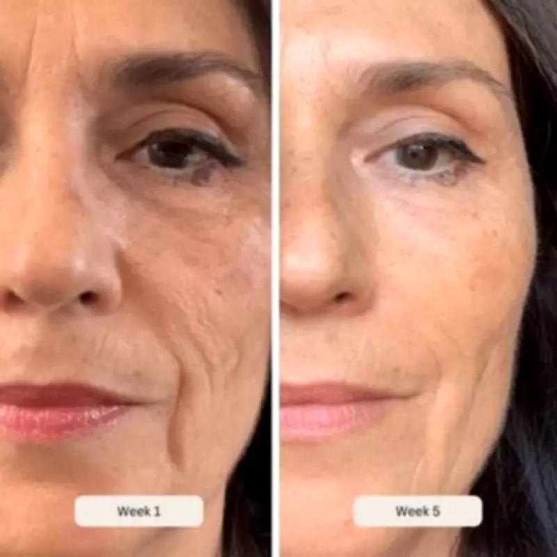 Salon-Grade LED Mask with £220 Off for Youthful Skin in Two Weeks