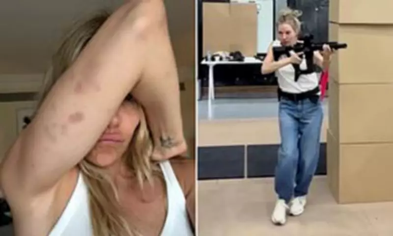 Sienna Miller Shows Off Gruesome Bruises From Jack Ryan Role