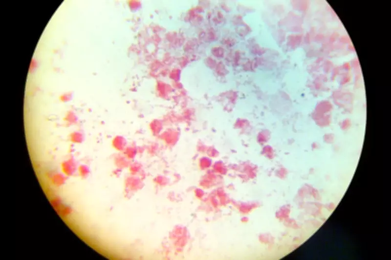 STI Cases Hit Record Highs in Europe as Gonorrhea and Syphilis Surge