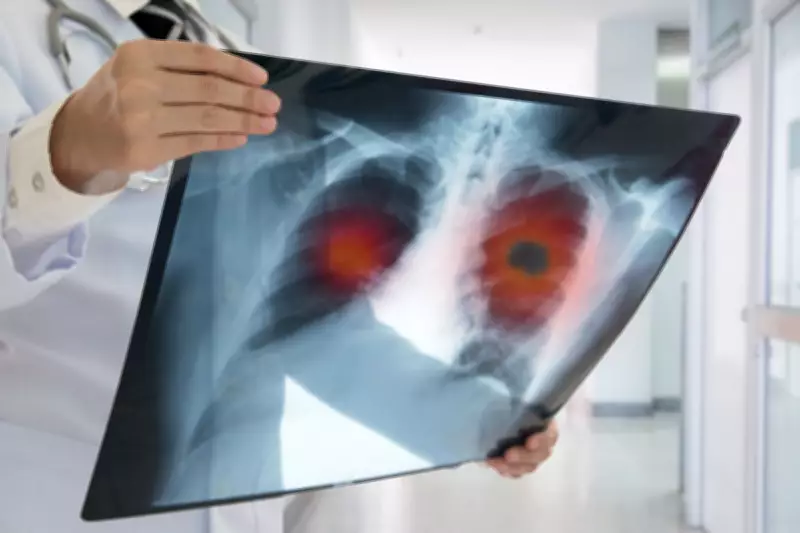 Supermarket Lung Cancer Checks Detect 10,000 Cases in England