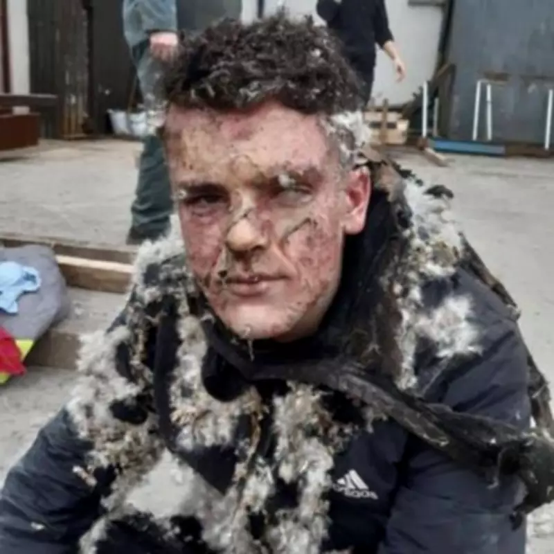 Teen Welder Begged Nurses to Let Him Die After Fireball Horror Burns