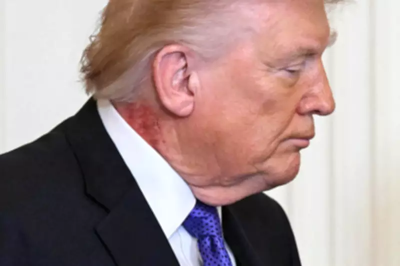 Trump Health Report Omits Neck Rash, Shows Weight Gain