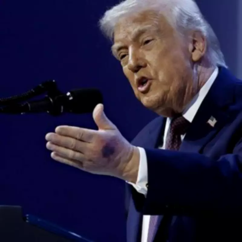 Trump Says Bruising on Hand Is Side Effect of Aspirin Use