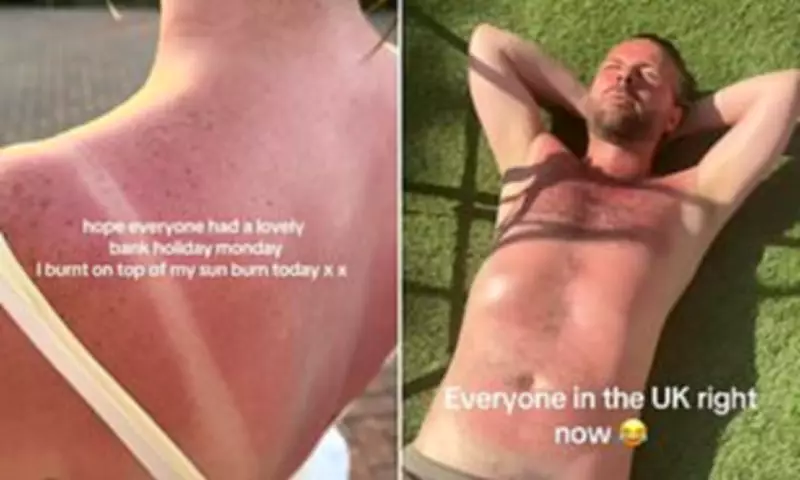 UK Heatwave Sparks Sunburn Warnings as Melanoma Cases Hit Record High