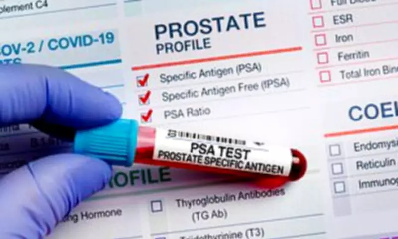 UK Rejects Prostate Cancer Screening for Most Men, Sparking Outrage