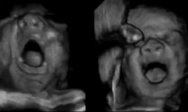 Unborn Babies Catch Yawns from Mothers, Study Reveals