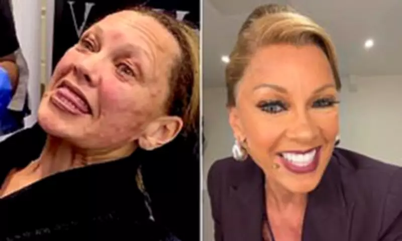 Vanessa Williams, 63, Shows Off Regenerative Face Treatment Results