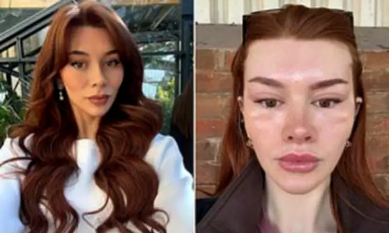 Woman Spends £9,000 on Facelift to Mimic Bella Hadid’s Cat Eye Look