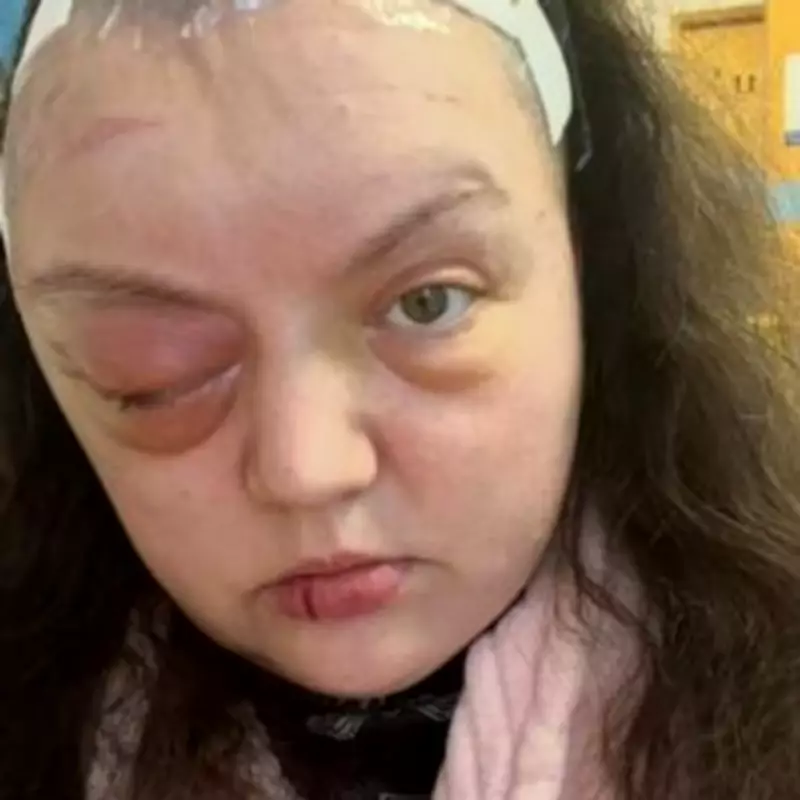 Woman Sues Pfizer Over Brain Tumour from 21 Years of Contraceptive Jab