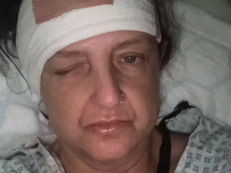Woman Told to Take Paracetamol by NHS 111 Later Found Comatose with Meningitis