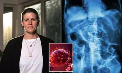 Bowel Cancer Rates Triple in Young Australians: Urgent Need for New Care Models