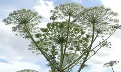 Boy, 8, Left with Scar After Giant Hogweed 'Toy Axe' Burns