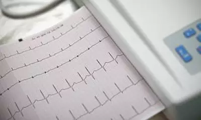 Low Resting Heart Rate May Also Signal Stroke Risk, Study Finds