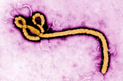 Major Ebola Outbreaks: From 1976 to Present Congo Crisis