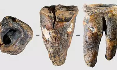 Neanderthal 'Dentists' Used Stone Drills to Treat Cavities 60,000 Years Ago