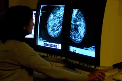 New genome test could spare millions of breast cancer patients chemotherapy