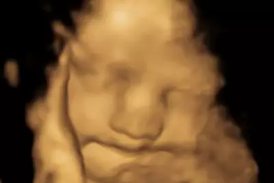Prenatal Vegetable Exposure May Shape Kids' Food Preferences, Study Finds