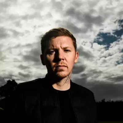 Professor Green Reveals Four Tumours: One Behind Eye, Three on Spine