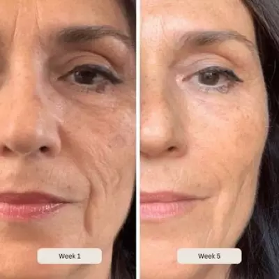 Salon-Grade LED Mask with £220 Off for Youthful Skin in Two Weeks