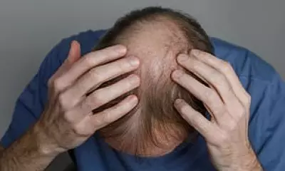 UK Drug Watchdog Warns of Serious Side Effects from Hair-Loss Drugs