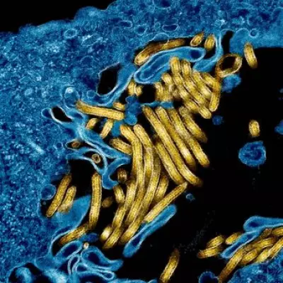 WHO Admits Ebola Outbreak Began Months Before Detection After US Criticism