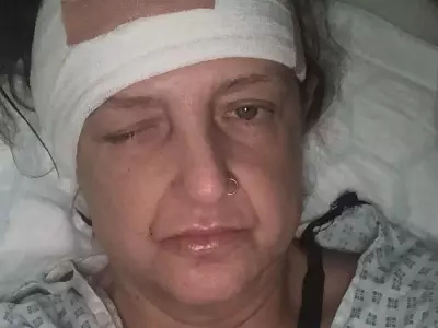 Woman Told to Take Paracetamol by NHS 111 Later Found Comatose with Meningitis