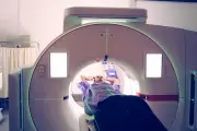 AI Detects Pancreatic Cancer Signs Years Before Diagnosis