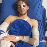 Brit Left with £23,000 Medical Bill After Thailand Bike Crash