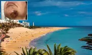 British grandmother wins £23,000 after fall on Fuerteventura hotel path