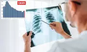 California TB Cases Hit 12-Year High: 2,150 Infections, 279 Deaths in 2025