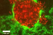 Cell Size May Explain Why Some Cancers Are More Dangerous