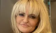 Danniella Westbrook Prepares for Corrective Lip Surgery After Facial Reconstruction