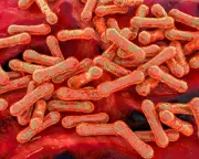 Diphtheria Outbreak Hits Remote Aboriginal Communities in NT