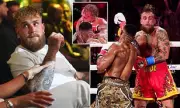 Jake Paul Faces Possible End to Boxing Career After Broken Jaw