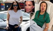 Janice Dickinson, 71, Reveals Dramatic Facelift Results After Fall Injury