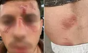 Jewish man brutally attacked in Golders Green after speaking Hebrew on phone