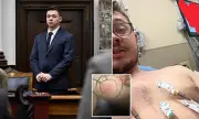 Kyle Rittenhouse Hospitalized After Venomous Spider Bite, Vows Revenge