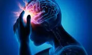 Lacunar Strokes Linked to Artery Widening, Not Blockages, Study Finds