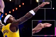 Lakers' Jarred Vanderbilt Suffers Horrific Finger Injury in Playoff Game