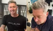 Michael Clarke Reveals Another Skin Cancer Surgery on His Face