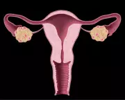 NHS Urged to Update Website After Renaming PCOS to PMOS