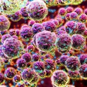 Reading Meningitis Outbreak: Teen Dies, Two Schoolchildren Infected