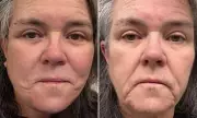 Rosie O'Donnell Reveals Secret Facelift After Feminist Crisis