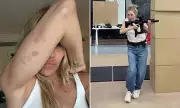 Sienna Miller Shows Off Gruesome Bruises From Jack Ryan Role